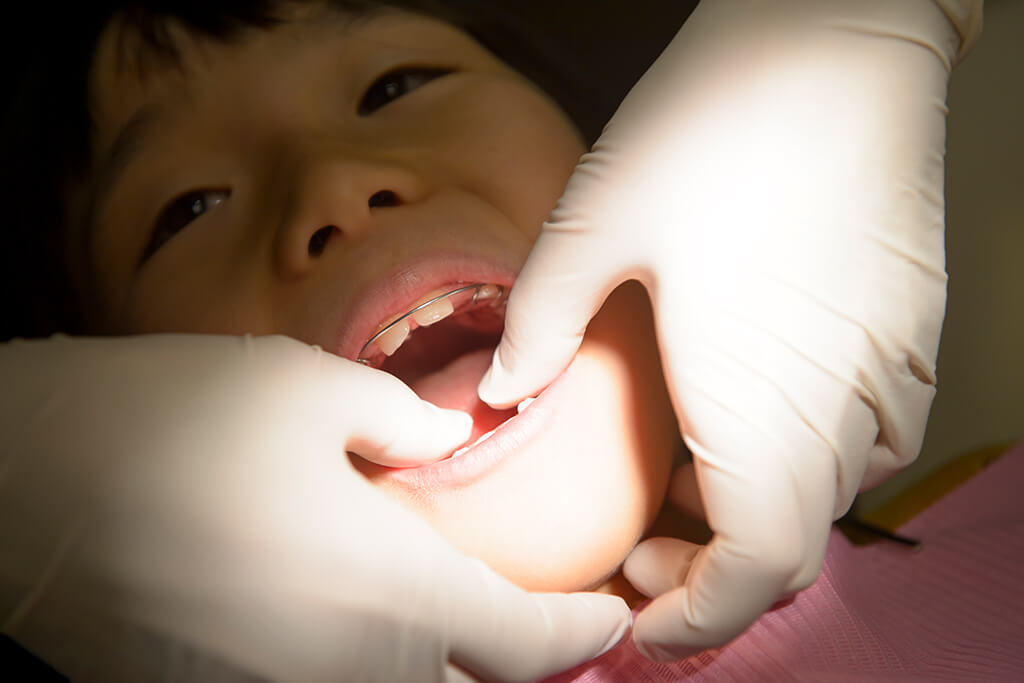 柴田郡の歯医者・後藤歯科医院・STEP2